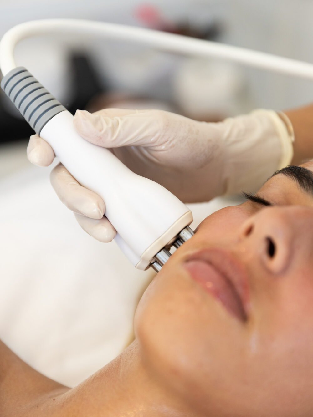 טיפול זוהר ומיצוק בשילוב rf